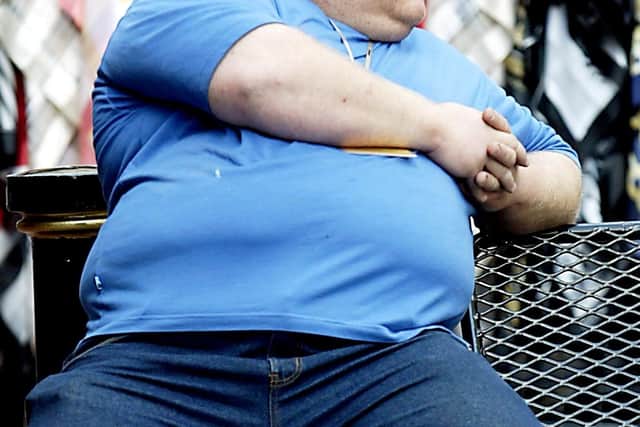 More than a quarter of Scots believe people who are overweight or obese “have only themselves to blame”