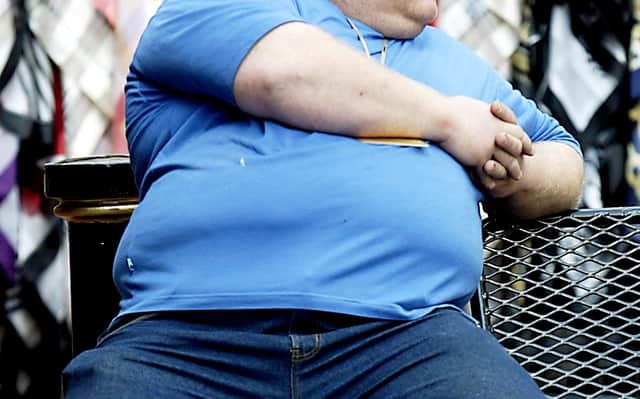 More than a quarter of Scots believe people who are overweight or obese “have only themselves to blame”