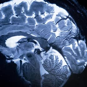 A group of 20 experts will analyse data from CT and MRI scans using AI