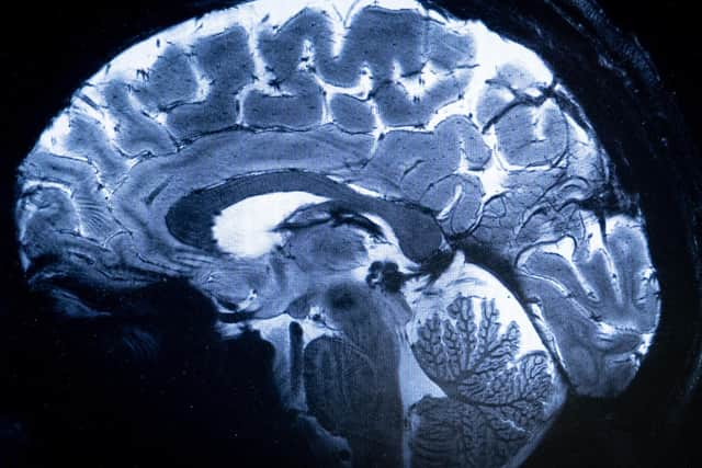 A group of 20 experts will analyse data from CT and MRI scans using AI