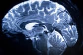 A group of 20 experts will analyse data from CT and MRI scans using AI