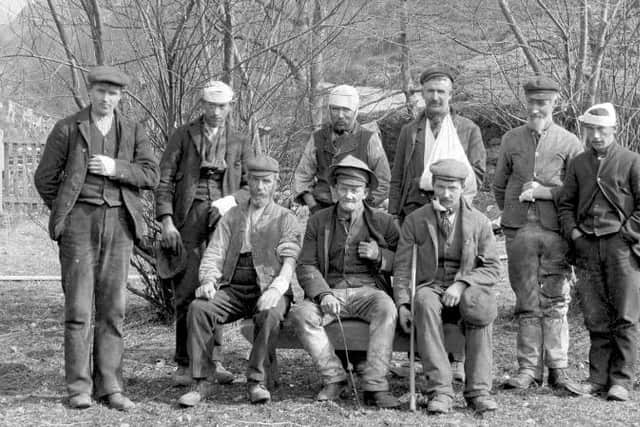 A group of injured workers. Picture: Glenfinnan Station Museum