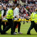 Hibs lost Chris Cadden to a serious Achilles injury during the 1-1 draw against Hearts - their third big match in six days.