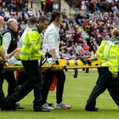 Hibs lost Chris Cadden to a serious Achilles injury during the 1-1 draw against Hearts - their third big match in six days.