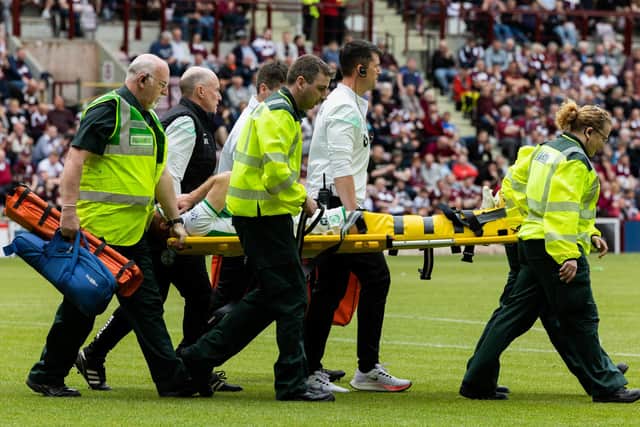 Hibs lost Chris Cadden to a serious Achilles injury during the 1-1 draw against Hearts - their third big match in six days.