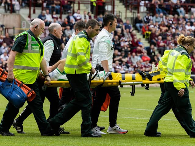 Hibs lost Chris Cadden to a serious Achilles injury during the 1-1 draw against Hearts - their third big match in six days.