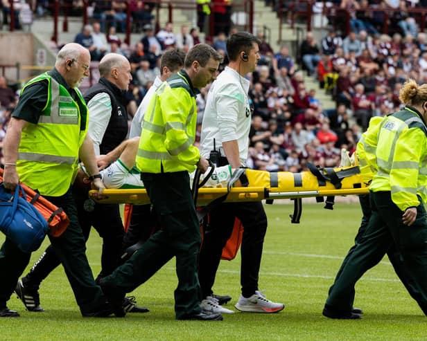 Hibs lost Chris Cadden to a serious Achilles injury during the 1-1 draw against Hearts - their third big match in six days.