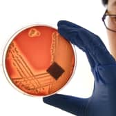 A researcher inspects a strain of the Staphylococcus epidermidis that is highly resistant to antibiotics (Picture: William West/AFP via Getty Images)
