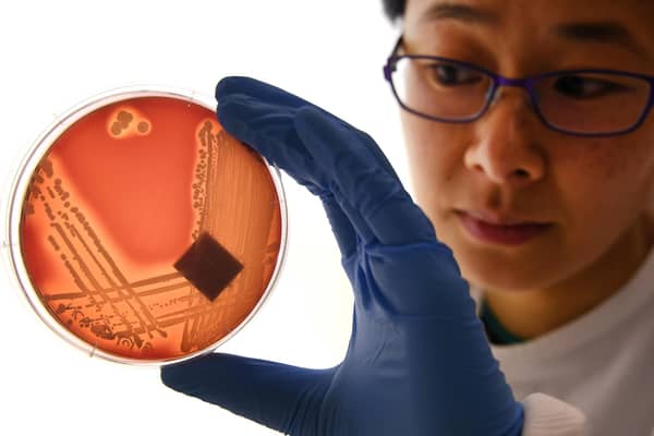 A researcher inspects a strain of the Staphylococcus epidermidis that is highly resistant to antibiotics (Picture: William West/AFP via Getty Images)
