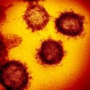 The number of coronavirus cases in the UK continues to rise.