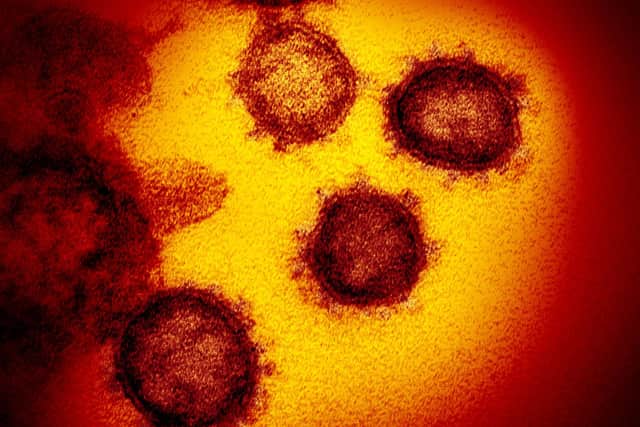 The number of coronavirus cases in the UK continues to rise.