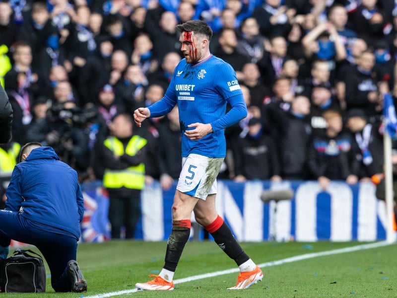 The Scotland defender started the game off in a flustered manner as Celtic threatened to run away with the match. Left the pitch with blood pouring from a head wound. Bandaged up, he kept on going until the very end. 6