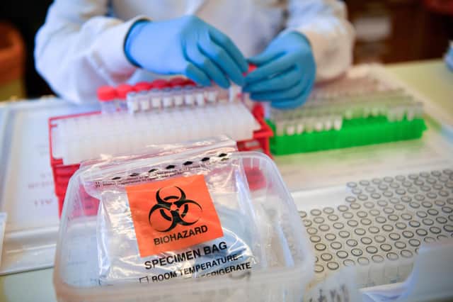 Deaths from Covid-19 have almost returned to pre-lockdown levels, say the NRS.