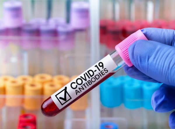 Immunity to Covid-19 may reduce over time, just like it does with other illnesses (Shutterstock)
