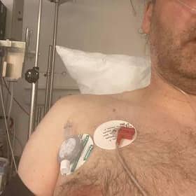 David required a tube to drain fluid from his punctured lung