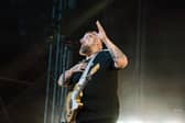 Rag'n'Bone Man has cancelled a second European tour date this week, as he continues to deal with a medical issue.