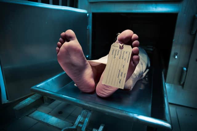 Concerns have been raised over a shortage of cadavers in Scotland