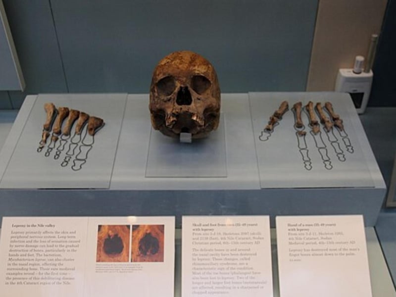 In 1936, Sir Alexander Seton and his well-off family owned a house in Learmonth Gardens that would become home to the supernatural. After he and his family took a trip to the Temple of Luxor in Egypt they brought a souvenir back with them - a bone from the ruins despite being told to leave everything untouched. Oblivious to the legend of cursed objects, the family reported ghostly figures and loud bangs suddenly occurring at home upon returning, Alexander’s wife also became ill with a disease doctors could not diagnose as did Alexander. In response Seton surrendered the bone to the priest for it to be exhumed and the chaos finally ceased.
