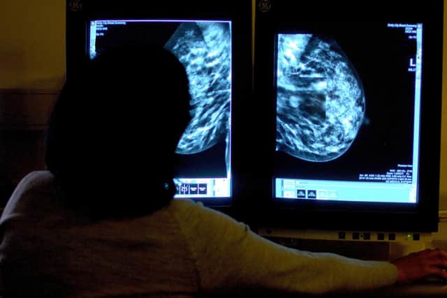 Catching cancer early is a key factor if treatment is to be successful (Picture: Rui Vieira/PA)