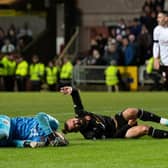 Hearts goalkeeper suffered the leg injury after a heavy collision with Dundee United striker Steven Fletcher.