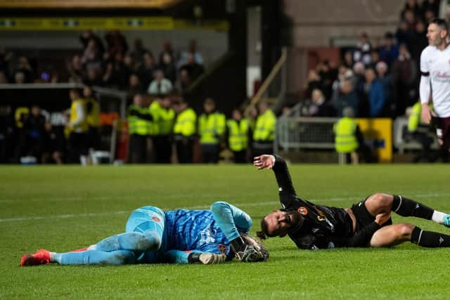 Hearts goalkeeper suffered the leg injury after a heavy collision with Dundee United striker Steven Fletcher.