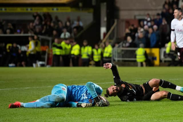 Hearts goalkeeper suffered the leg injury after a heavy collision with Dundee United striker Steven Fletcher.