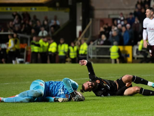 Hearts goalkeeper suffered the leg injury after a heavy collision with Dundee United striker Steven Fletcher.