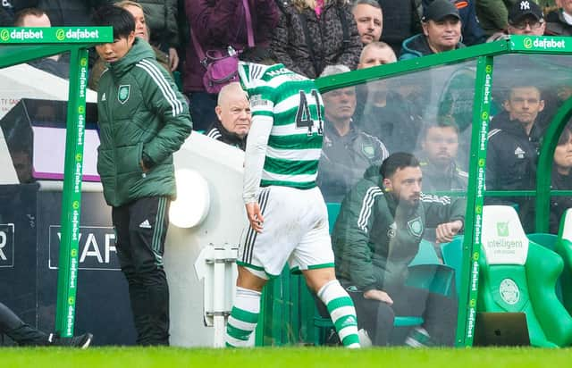 Reo Hatate picked up an injury for Celtic when they last played against Hibs.