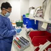 A pathology trainee biomedical scientist (BMS) in microbiology, prepares Covid-19 tests for analysis in the laboratory at Whiston Hospital in Merseyside in October 2020.