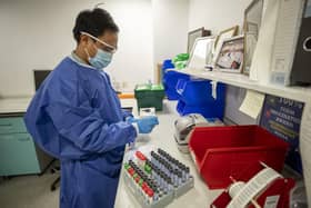 A pathology trainee biomedical scientist (BMS) in microbiology, prepares Covid-19 tests for analysis in the laboratory at Whiston Hospital in Merseyside in October 2020.