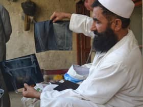 Mostaqim with x-ray images of the injuries he sustained in a suicide bomb attack.
