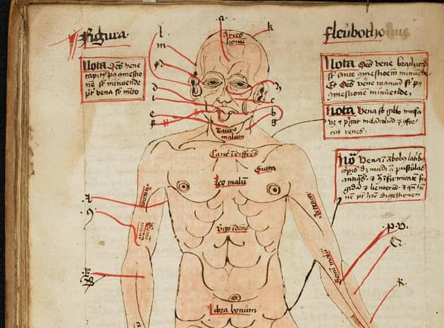 A diagram of the human body, showing the veins to be opened for blood-letting, from the 16th century (Image: Master and Fellows of Trinity College/Cambridge University/PA)