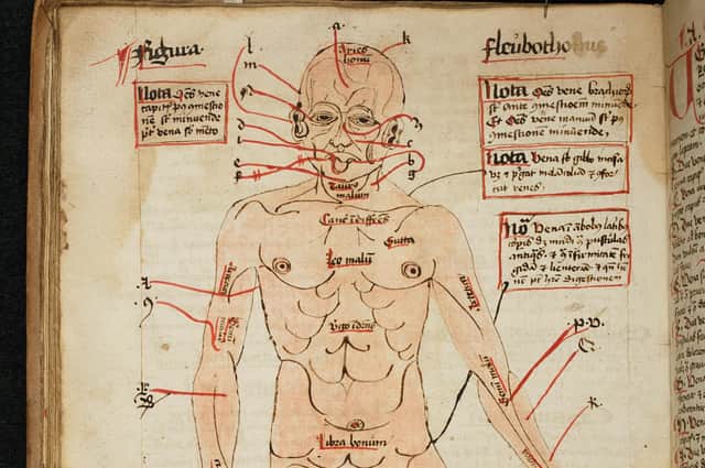 A diagram of the human body, showing the veins to be opened for blood-letting, from the 16th century (Image: Master and Fellows of Trinity College/Cambridge University/PA)