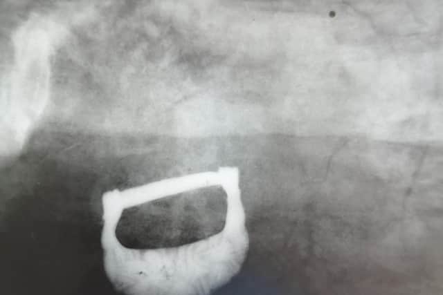 An x-ray of the buckle found in one of the graves.