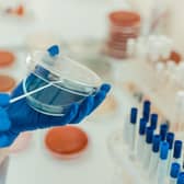 Since 2014, the Industrial Biotechnology Innovation Centre (IBioIC) has played a key role in the growth of Scotland’s industrial biotechnology sector.