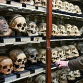 Professor Tom Gillingwater, chair of anatomy at the University of Edinburgh, in the institution's Skull Room. Picture: Neil Hanna