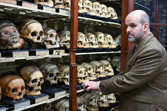 Professor Tom Gillingwater, chair of anatomy at the University of Edinburgh, in the institution's Skull Room. Picture: Neil Hanna