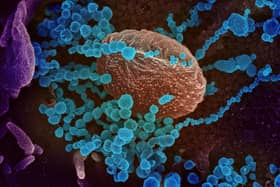 Fragments of non-infectious genetic material from Covid-19 are secreted by patients and end up in the sewerage system
