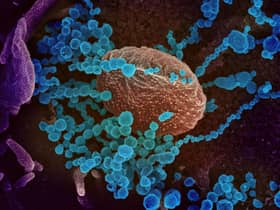 Fragments of non-infectious genetic material from Covid-19 are secreted by patients and end up in the sewerage system