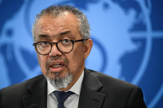 WHO Director-General Tedros Adhanom Ghebreyesus speaks during a press conference on Ebola outbreak in Democratic Republic of Congo and Uganda, in Geneva, on May 20, 2026. The spread of Ebola in the Democratic Republic of Congo means the outbreak likely began a few months ago, the WHO said on May 20, 2026. (Photo by Fabrice COFFRINI / AFP via Getty Images) : Tedros Adhanom Ghebreyesus