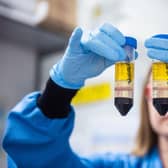 A researcher in a laboratory at the Jenner Institute working on the coronavirus vaccine developed by AstraZeneca and Oxford University. Picture: John Cairns/University of Oxford/PA Wire