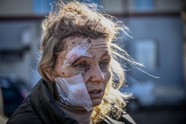 Helena, a 53-year-old teacher, stands wounded and in shock outside a hospital on the first day of the war after Russian forces bombed the town of Chuguiv (Picture: Aris Messinis/AFP via Getty Images)
