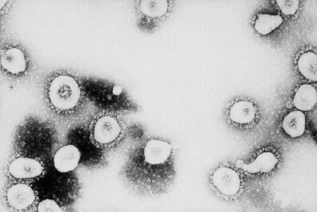 A microscopic view of the coronavirus that causes Covid (Picture: US Centres for Disease Control and Prevention/Getty Images)