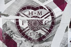 Hearts are missing a number of experienced players against Brora Rangers.