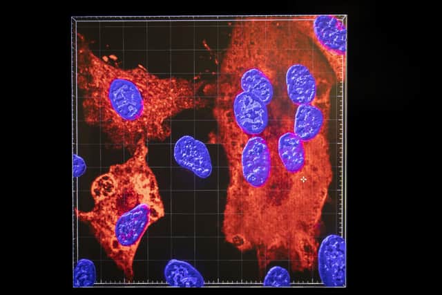 Cell nuclei, stained in blue, are shown being infected by Sars-CoV-2, in red, the virus which causes Covid-19 (Picture: Jane Barlow/PA)