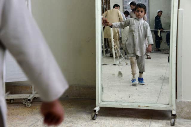 A child amputee practices walking with his prosthetic leg at an International Committee of the Red Cross (ICRC) hospital in Jalalabad in 2014 (Picture: Noorullah Shirzada/AFP via Getty Images)