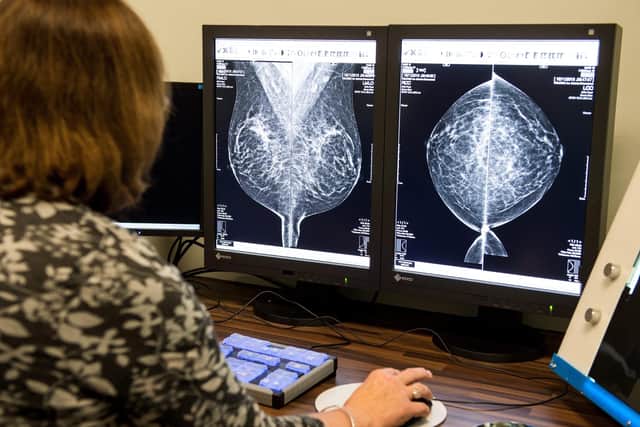 Cancer waiting time performance has hit a record low in Scotland. Picture: SWNS