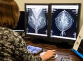 Cancer waiting time performance has hit a record low in Scotland. Picture: SWNS