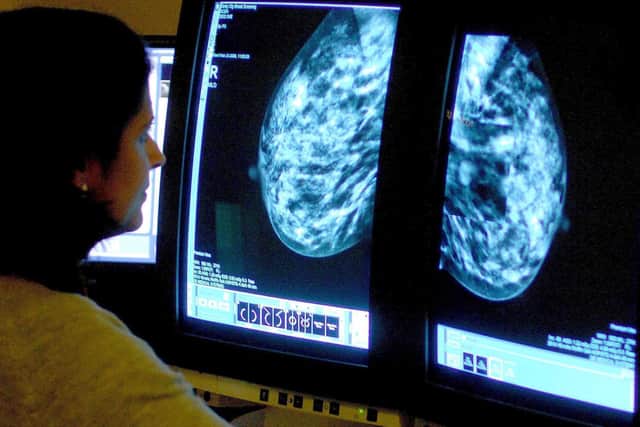 A consultant analysing a mammogram. Picture: PA Media