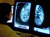 A consultant analysing a mammogram. Picture: PA Media